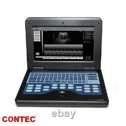 CONTEC 100% Warranty Portable Laptop Digital Ultrasound Scanner Machine, CMS600P2