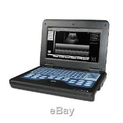 CONTEC Portable Ultrasound Scanner Laptop Machine Digital Optional Probes Free
