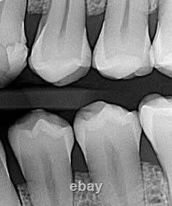 Digital Dental X Ray Machine intra-oral Imaging Unit +Case X-Ray