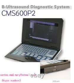 Digital ultrasound scanner Portable machine, + 2 probes, 2y warranty, CE CMS600P2