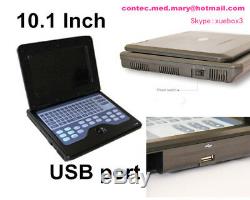 FDA, CE CONTEC Portable Ultrasound Scanner Laptop Machine, 7.5MHz Linear Probe, NEW
