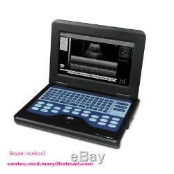 FDA CONTEC Portable Laptop Machine Human Ultrasound Scanner, 3.5 Convex, USA Fedex