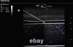 Mindray M7 Premier Ultrasound machine (2018 system) -Lightly Used Under Warranty