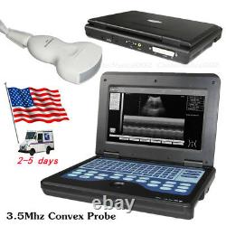 US Portable Ultrasonic Ultrasound Scanner/Machine 3.5MHz Convex Transducer Probe