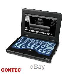 US Seller CE Digital Ultrasound Scanner Portable laptop machine 3.5 Convex Probe