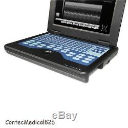 USA LCD Portable Ultrasound Scanner Laptop Machine with 3.5Mhz Convex Probe, Hot