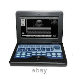 USA Ultrasound Scanner Laptop Machine ultrasonic 3.5Mhz Convex Probe Obstetrics