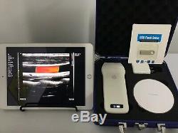 Wireless Wifi ultrasound scanner Convex Color Doppler Machine 192E IOS/Android