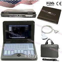 10.1 Fda Cms600p2 Ce Numérique Portable Machine À Ultrasons Scanner Convexe 3.5mhz, États-unis