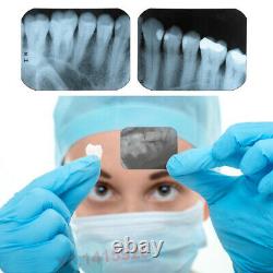 Appareil Dentaire Portatif X-ray Machine D'imagerie Numérique Portative Blx-5