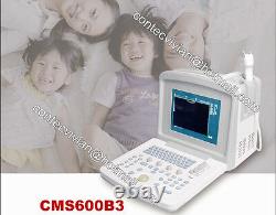 Cms600b3 Bureau Ultrasound Scanner Machine + 3.5 Sonde Convex, Haute Qualité + Ce