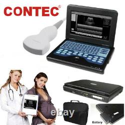 Contec 100% Garantie Pour Ordinateur Portable Numérique Portable Machine À Ultrasons Scanner, Cms600p2