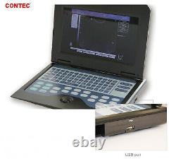 Contec 100% Garantie Pour Ordinateur Portable Numérique Portable Machine À Ultrasons Scanner, Cms600p2