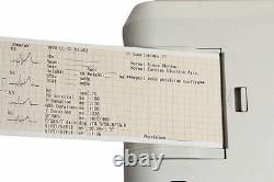 Contec Ecg300g Digital 3-channel 12-lead Electrocardiographe Ecg Machine +pc Sw
