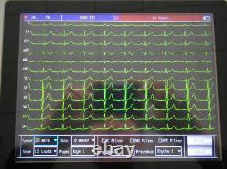 Contec Numérique 12 Canaux / Plomb Machine Ecg Ecg Électrocardiographe Sync Software