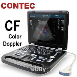 Couleur Doppler Ultrasound Scanner Portable Ordinateur Portable Couleur Convex Diagnostique