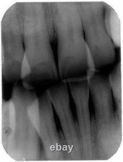Dental Digital X-ray Machine Sans Fil X-ray Système D'image Rouge Avec Boîte En Métal