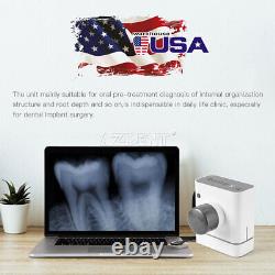 Équipement de laboratoire dentaire Unité dentaire portable Machine à rayons X 2 modèles de rayons X numériques