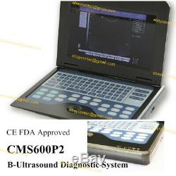 New USA Numérique Machine À Ultrasons Portable Scanner Cms600p2, Convex Probe 3.5mhz