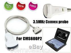 Nouveau 3.5mhz Convex Sonde Pour Ordinateur Portable Cms600p2 Portable Machine À Ultrasons Scanner