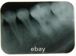 Nouveau Dental Handheld Digital X-ray Unit Surgical Mobile Machine Lab Equipment Ce