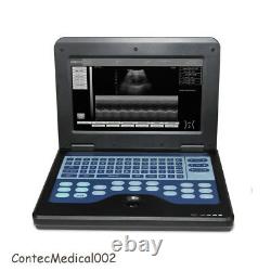 Ordinateur Portable Portable Scanner Numérique À Ultrasons, 3 Sondes, Convex/linear/cardiac