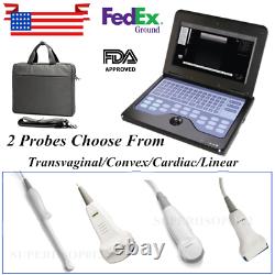 USA Fda Cms600p2 Scanner Numérique À Ultrasons B Machine Portable Portable 2 Sondes