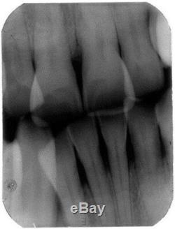 Unité Dentaire Mobile X-ray Machine De Radiographie Numérique À Faible Dose Système D'imagerie Us Stock