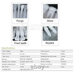 Us Dental Portable Digital X-ray Imaging Unit Machine Equipment Haute Fréquence