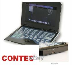 Us Vendeur Ce Numérique Echographe Ordinateur Portable Portable 3.5 Convex Probe